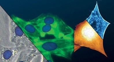 Correlated QI and optical images of live 3T3 fibroblast cells in cell culture medium at 37 °C. Cell nuclei and actin fluorescently labelled with Hoechst 33342 and CellMask™ Green Actin Tracking, respectively. DirectOverlay semi-transparent superimposition of fluorescence images with optical phase contrast and QI scan