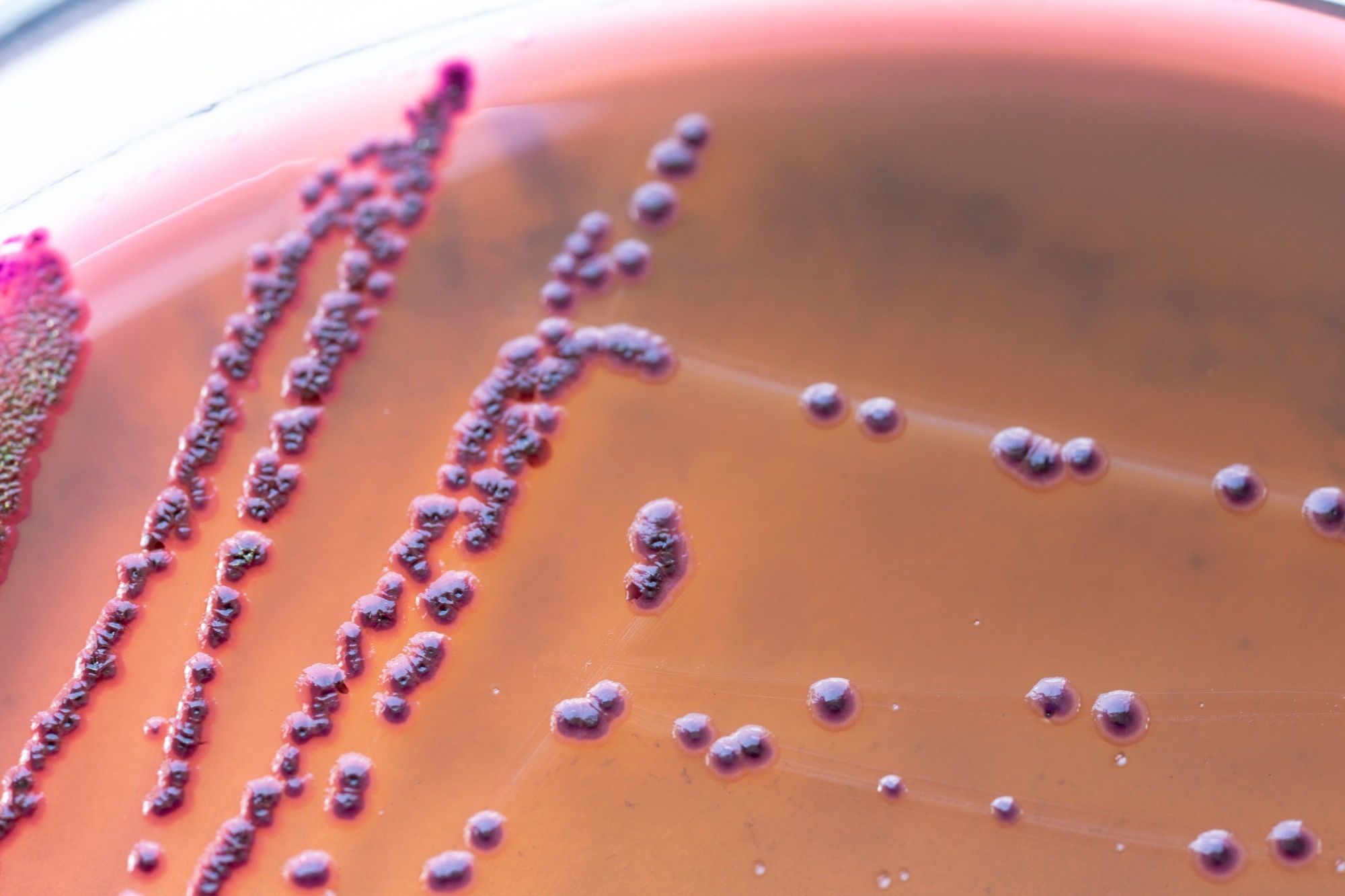 Plant Powered Quantum Dots Tackle Microbes and Toxic Dyes