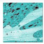 Atomic Force Microscopy and Its Working Principle from Bruker