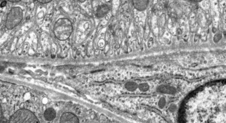 Au/TiO2 catalyst. Bright-field TEM image, accelerating voltage 120 kV.